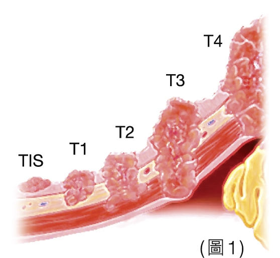 Self Photos / Files - Stomach Illustration